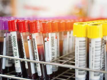 How can blood donors be encouraged to donate sample and data to biobanks