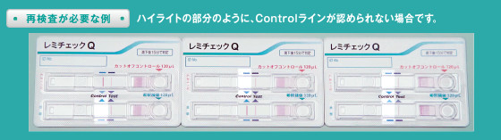  再検査が必要な例