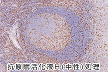 抗原賦活化液H（中性）処理